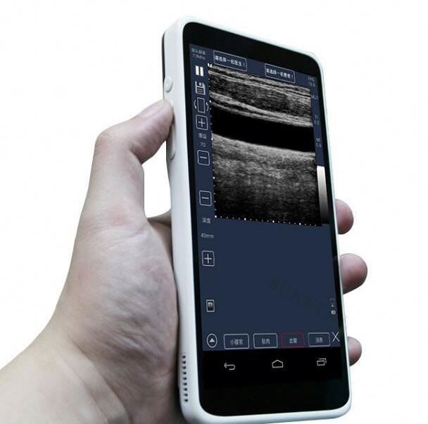 Phone mini portable pocket ultrasound machine price ultrasound scanner android cellphone ultrasound scanner