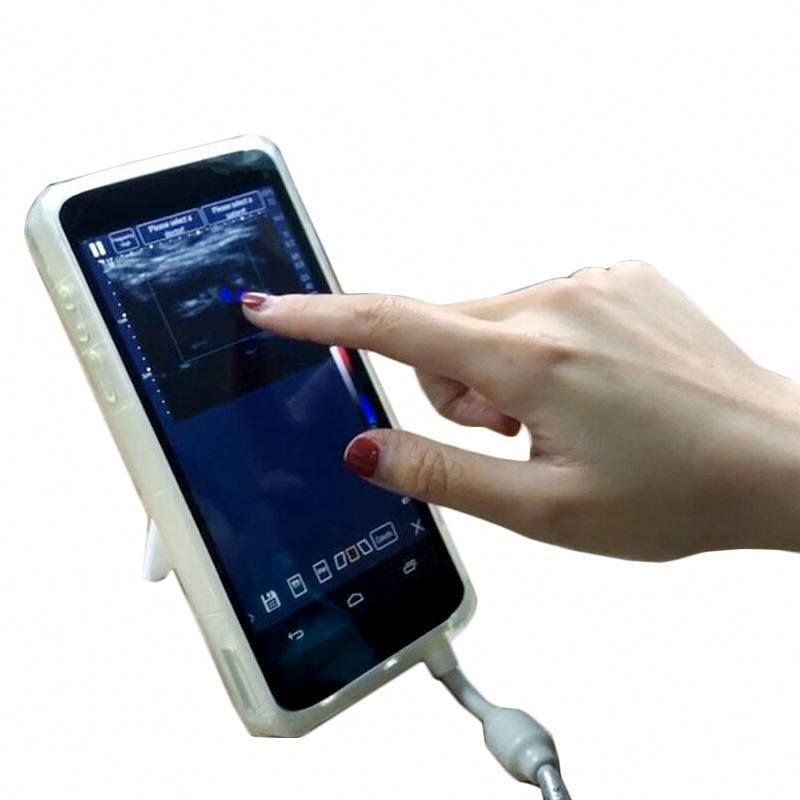 Phone mini portable pocket ultrasound machine price ultrasound scanner android cellphone ultrasound scanner