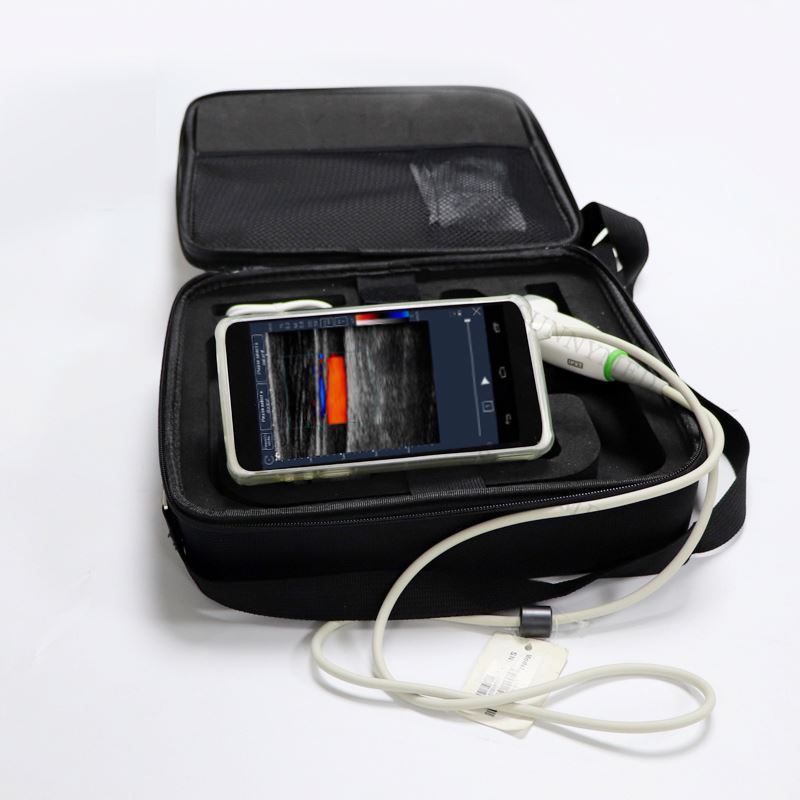 Phone mini portable pocket ultrasound machine price ultrasound scanner android cellphone ultrasound scanner