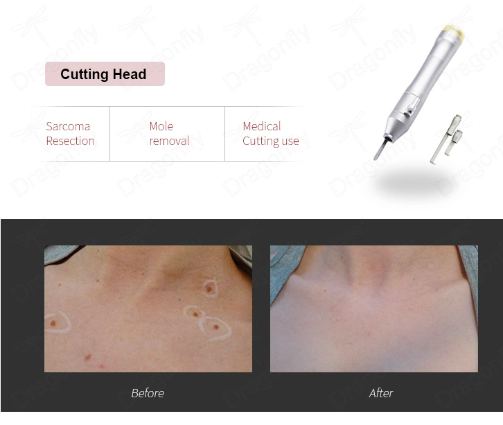 CO2 Fractional Laser Machine Stretch Marks Removal Vaginal Tightening Skin Rejuvenation Acne Scar Tightening Equipment