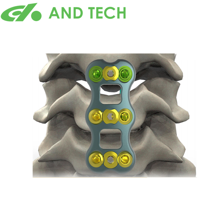 AND  titanium Orthopedic Spine System lower thickness spine titanium orthopedic implants Anterior cervical plate