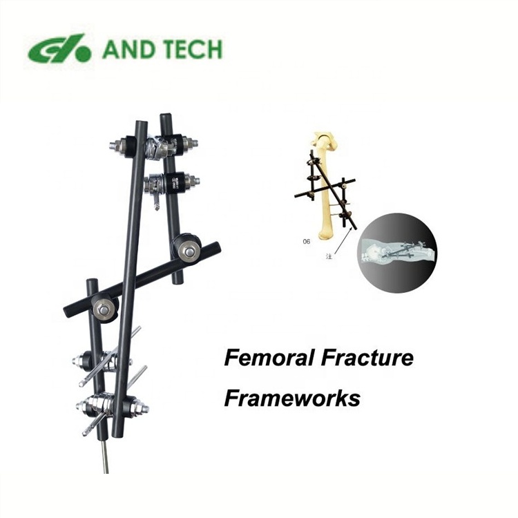 AND femoral external fixator external fixator femur orthopedic femur external fixator