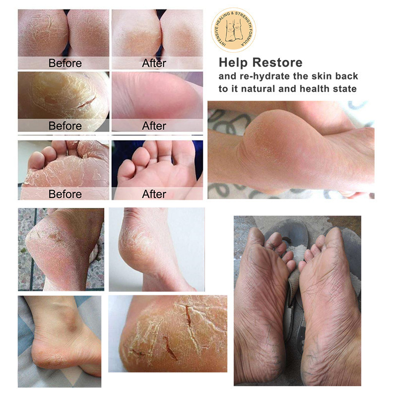 Exfoliating Foot Cream Tender Peeling Foot Care ointment Moisturizing feet Scrub Feet Pedicure Cream