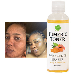 Free Sample Skin Whitening Dark Spots Eraser Turmeric Toner Corrector Acne Remover Tumeric Toner For Skin