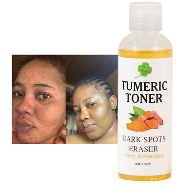 Free Sample Skin Whitening Dark Spots Eraser Turmeric Toner Corrector Acne Remover Tumeric Toner For Skin