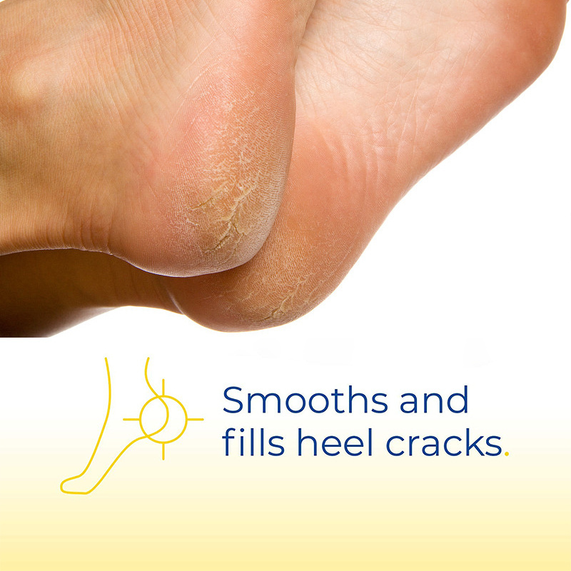 Private Label Softens Moisturizes Healthy Foot 25% Urea Dry Cracked Feet Cracked Heel Repair Balm