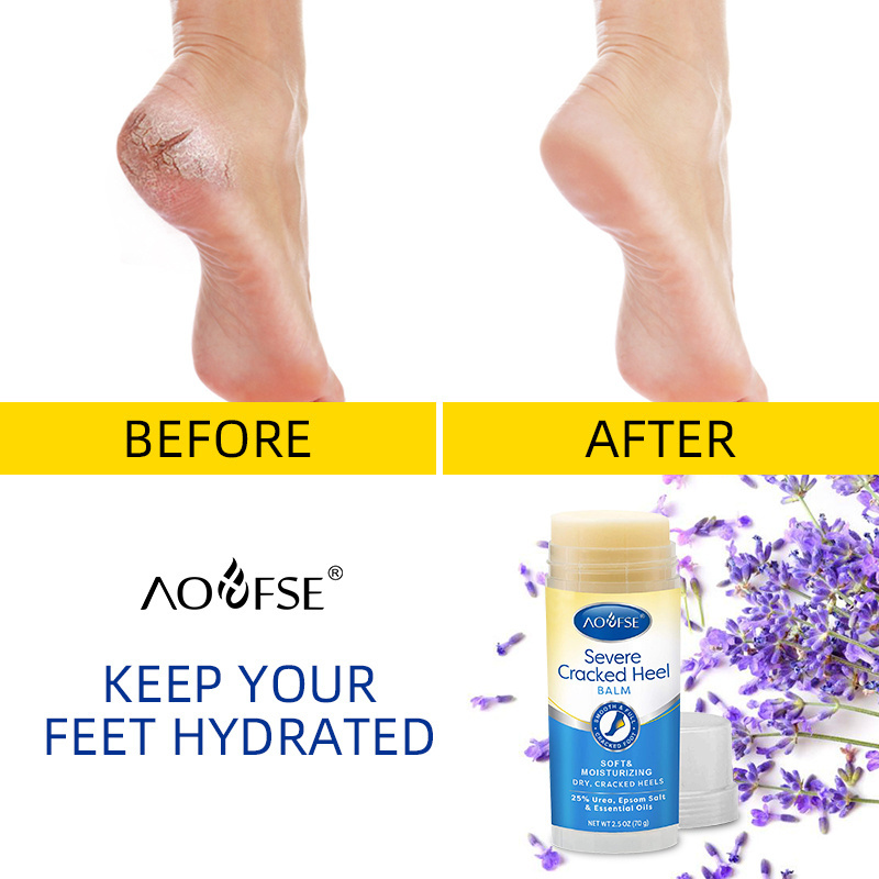 Private Label Softens Moisturizes Healthy Foot 25% Urea Dry Cracked Feet Cracked Heel Repair Balm