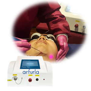 Arfurla 60 W high power 980 +1470 portable diode laser lipolysis laser invasive laser liposuction machine