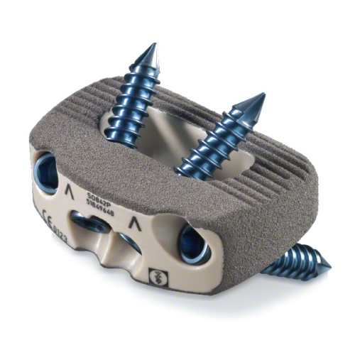 ISO Certified Plif Peek Cervical Cage with Screw For  Fixation Spine Orthopedic Implant