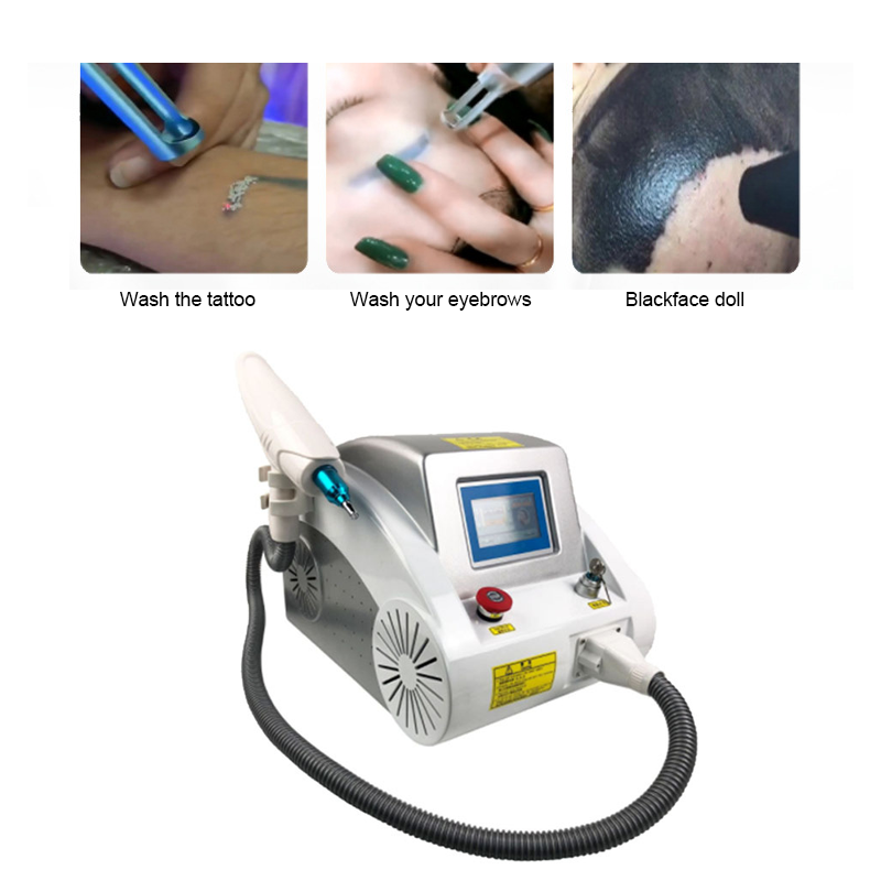 Best selling peel pigment beauty Equipment q switched nd yag laser tattoo removal machine nd yag q switched