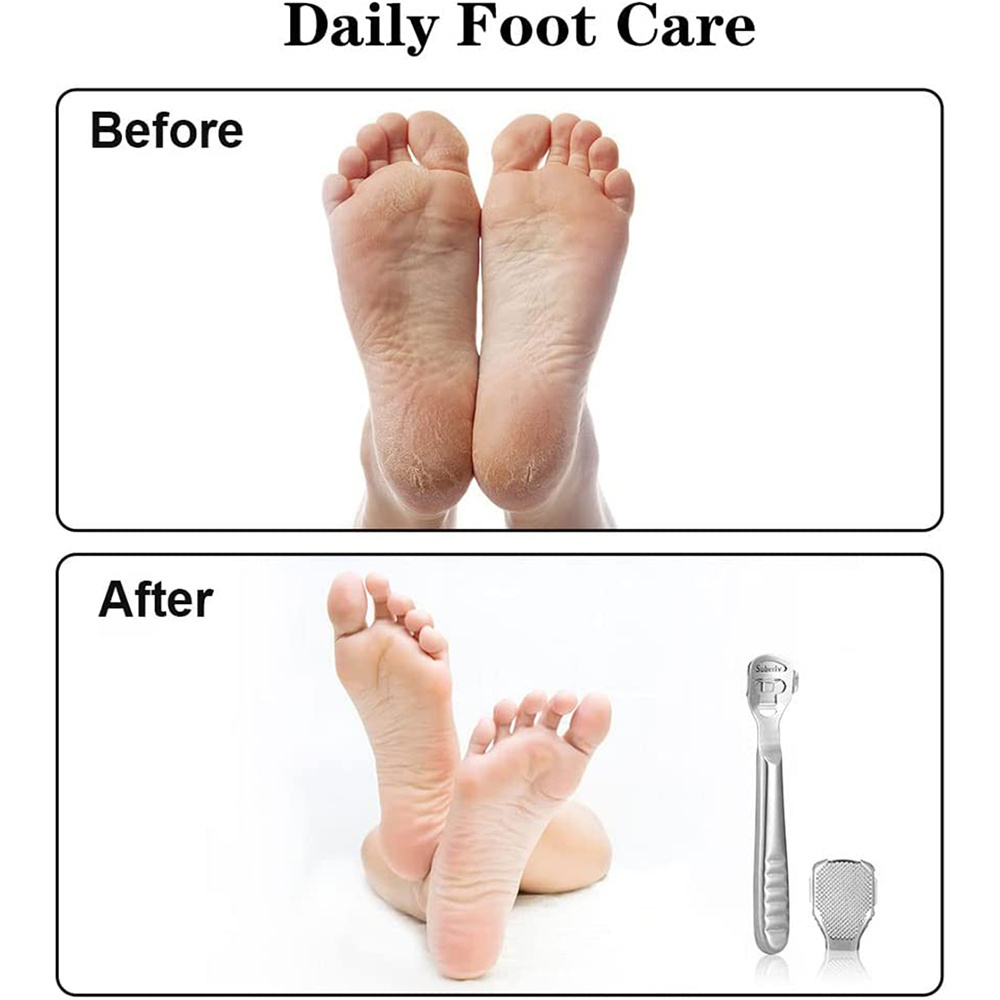 High Quality Polish Feet Foot Calluses Corn Pedicure Cutter Remover With Blade Foot Cleaning Tool Hard Skin Remover