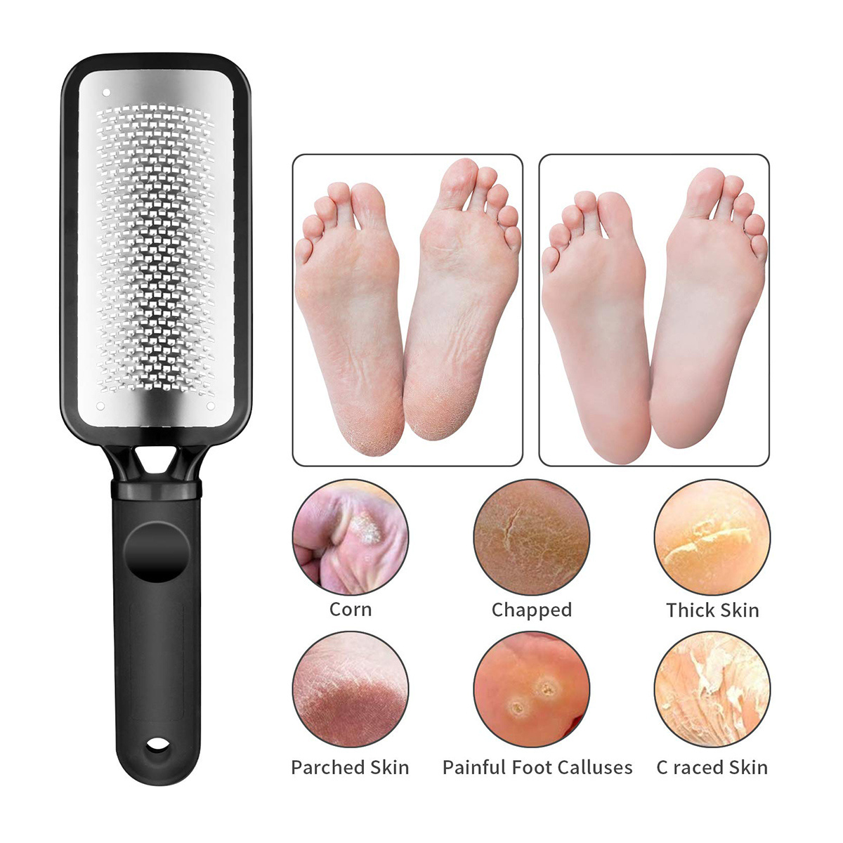 Professional Rasp Foot File Metal Surface Tool Remove Hard Skin for Wet and Dry feet Callus Remover File