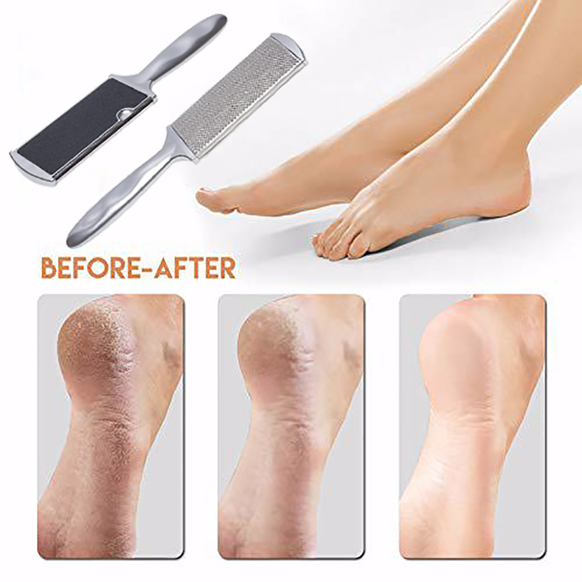 Foot Filer Wooden Callus Remover Foot File callus Remover Pedicure Tools Stainless Steel foot File