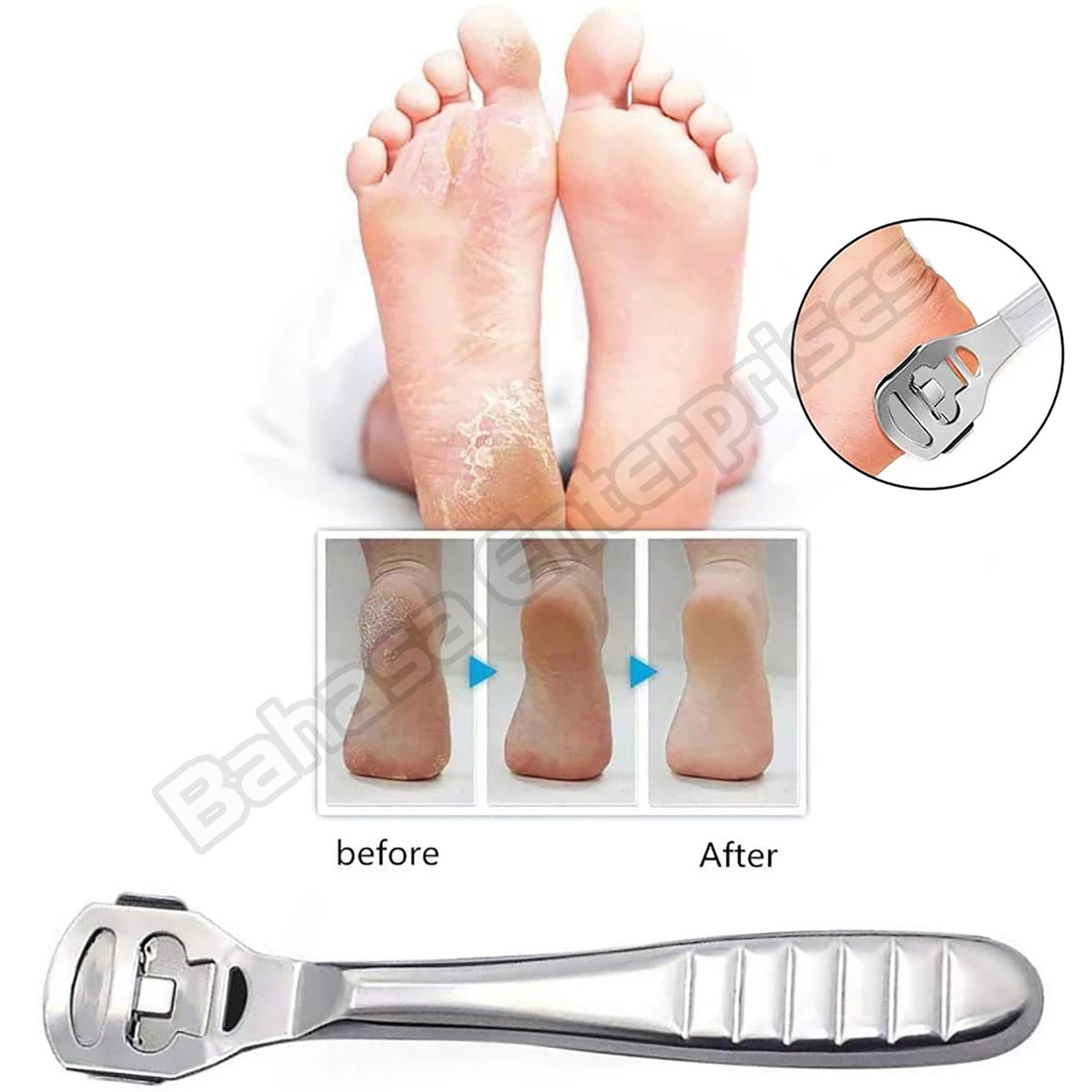 Foot Care Tool Stainless Steel 1pc Dead Skin Callus Remover Cutter Shaver Hard Skin Remover Callus remover Blade