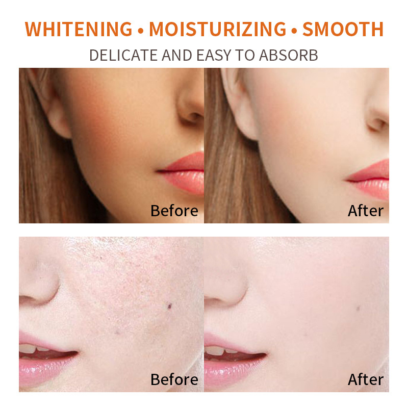 Custom Organic Vegan Private Label Skincare Dark Spot Removal Kojic Acid Glutathione Anti-aging Whitening Papaya Face Cream