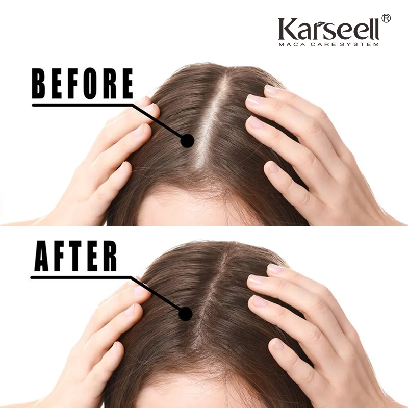 Karseell Private Label Organic Strenthening Repair Hair Treatment Extract Hair Growth Oil Argan Oil