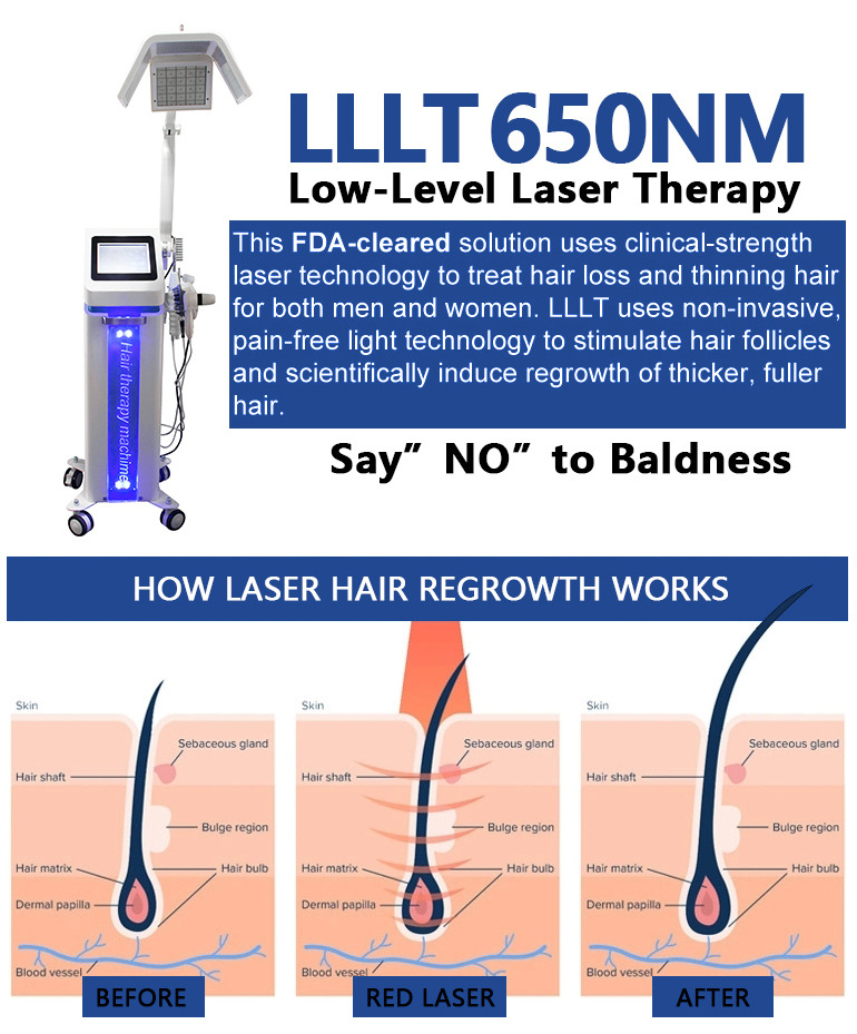 Professional 5 In 1 Hair Regrowth Grow 650nm Diode Laser Low Level Laser Therapy LLLT Scalp Analyzer Hair Growth Machine