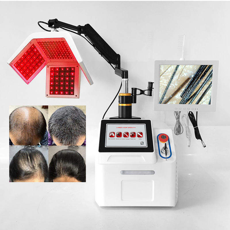 Scalp Treatment Detection System 650nm Laser Hair Growth Hair Regrowth Machine With High Frequency Comb Hair Analysis Machine