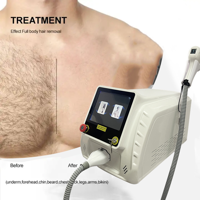 In Stock Hot Dual Heads Ice Ce Hair Removal Diode Laser 1600-2000w 755 808 1064nm 3 Wave