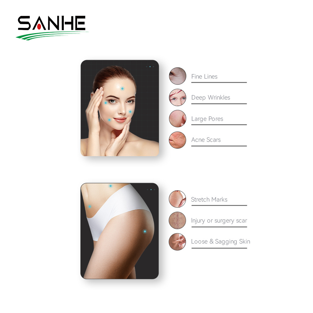 2022 SANHE Hot Portable Vacuum RF Face Lifting Stretch Marks Removal Vacuum RF Microneedling Machine For Salon Use