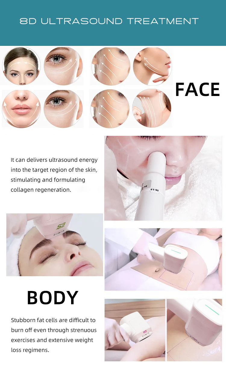 BECO 8D Ultrasonic Skin Tightening Smas Lifting Machine For face sculpting