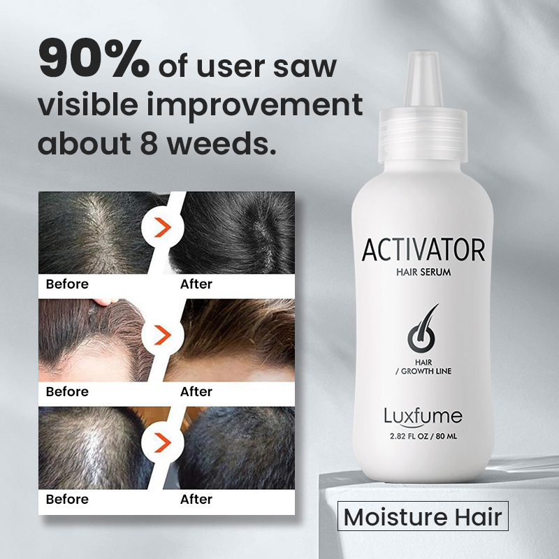 Luxfume private label Derma Roller biotin hair growth serum kit for Stimulate Hair Regrowth