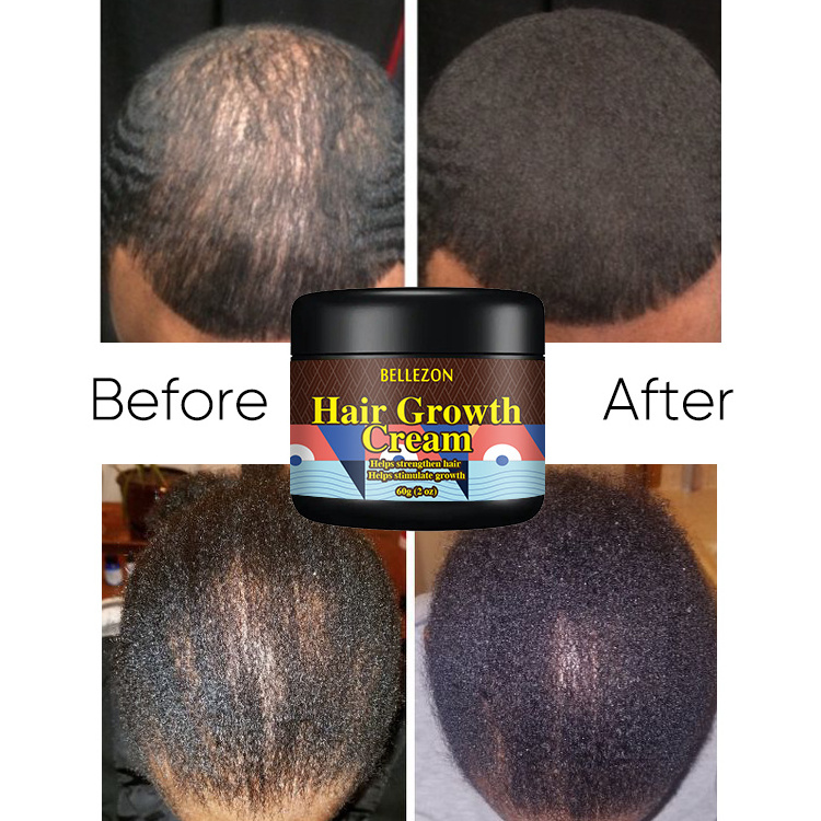 Custom Logo Hair Loss Regrowth Treatment Chebe Hair Cream Hair Growth Cream