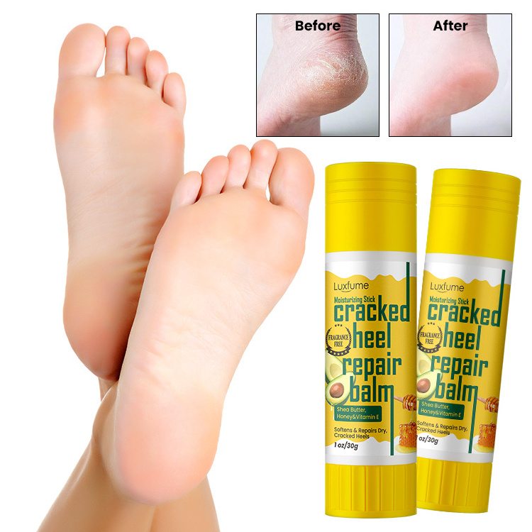 Wholesale Avocado Honey Smoothing Hand Foot Heel Balm Cracked Heel Repair Balm Stick