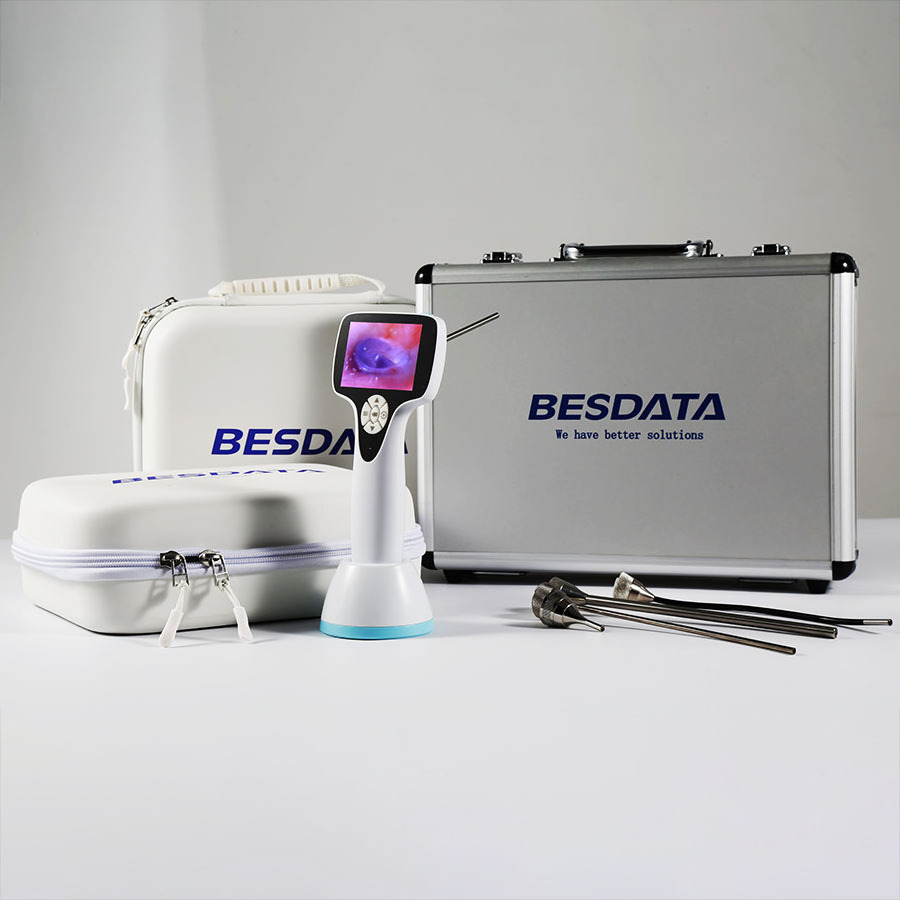 Ent Endoscopic ENT BESDATA portable HD Camera rigid Endoscope for ENT Diagnostic