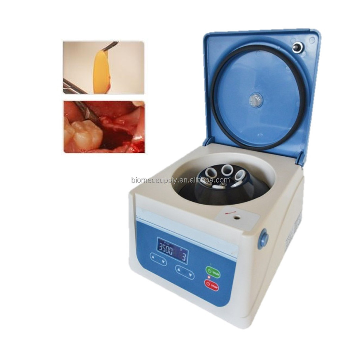 New Blood Plasma PRP Centrifuge Machine Exporter