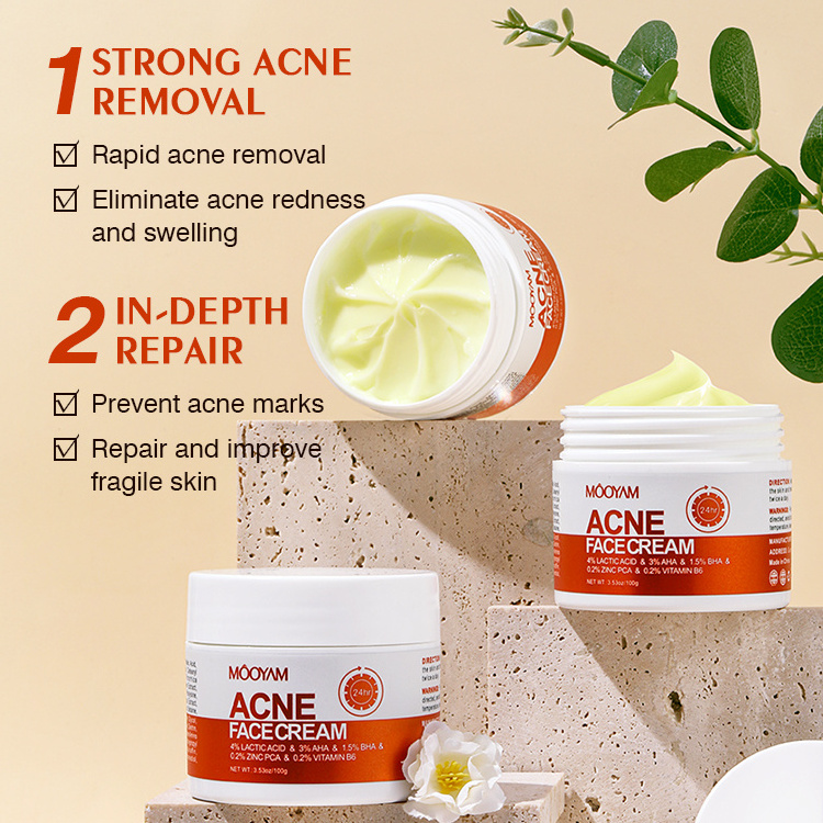 MOOYAM Herbal Acne Removal Cream Whitening Moisturizing Shrink Pores Oil Control Pimples Acne Treatment Gel Skin Care Face Cream