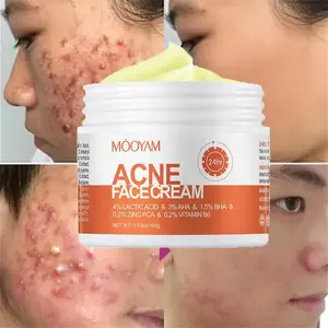 MOOYAM Herbal Acne Removal Cream Whitening Moisturizing Shrink Pores Oil Control Pimples Acne Treatment Gel Skin Care Face Cream