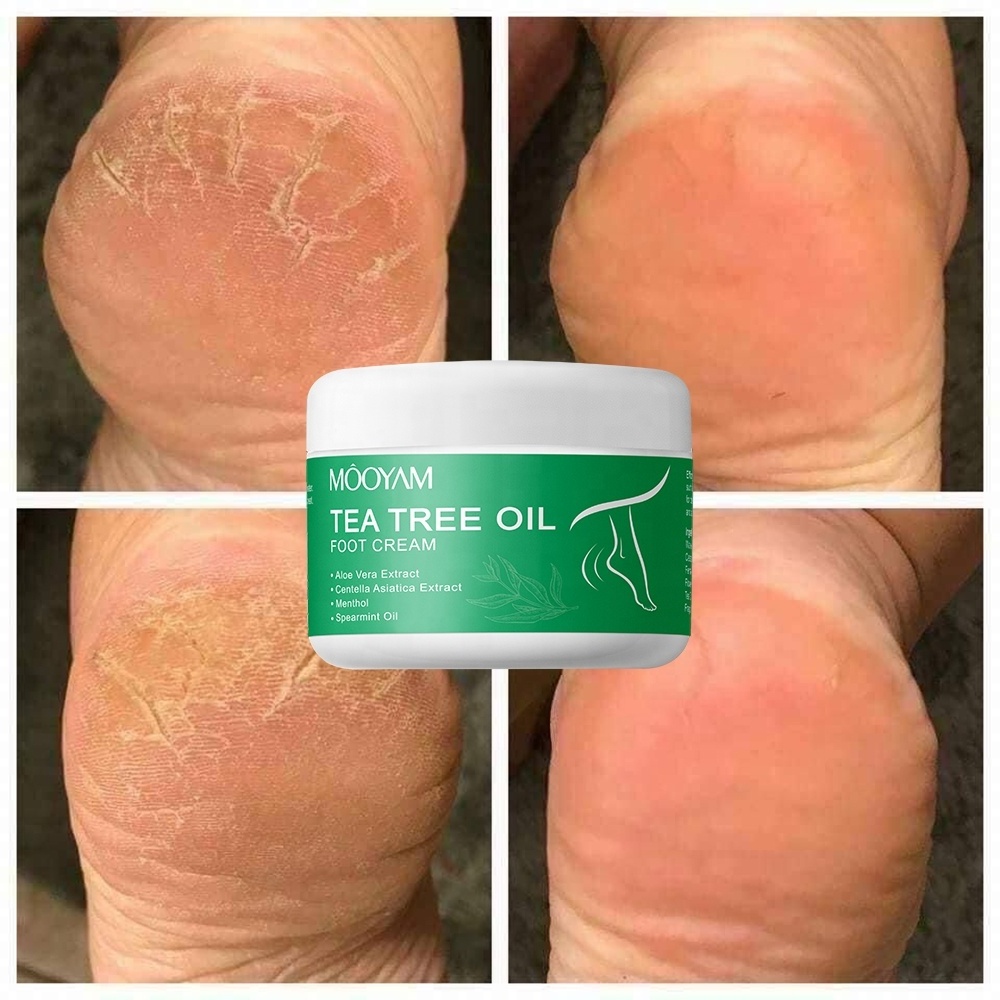 Private Label Foot Repair Care Cream Softens Conditions Dry Cracked Feet Heels Tea Tree Oil Foot Cream