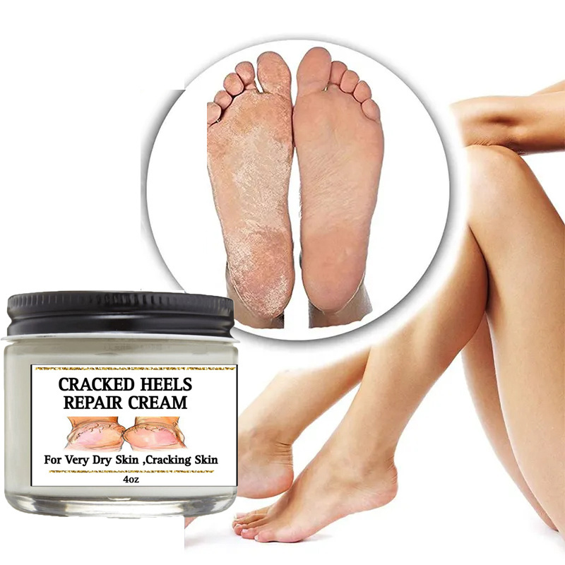 OEM ODM Cracked Heel Repair Tough Callus Remover Gel Callus Remover Cracked heels cream For Feet