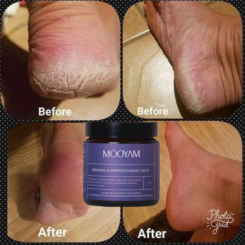 Anti Fungal Foot Repair Foot Scrub Exfoliation Dead Skin Removal Peeling Moisturizing Foot Care Repair Cream for cracked heels