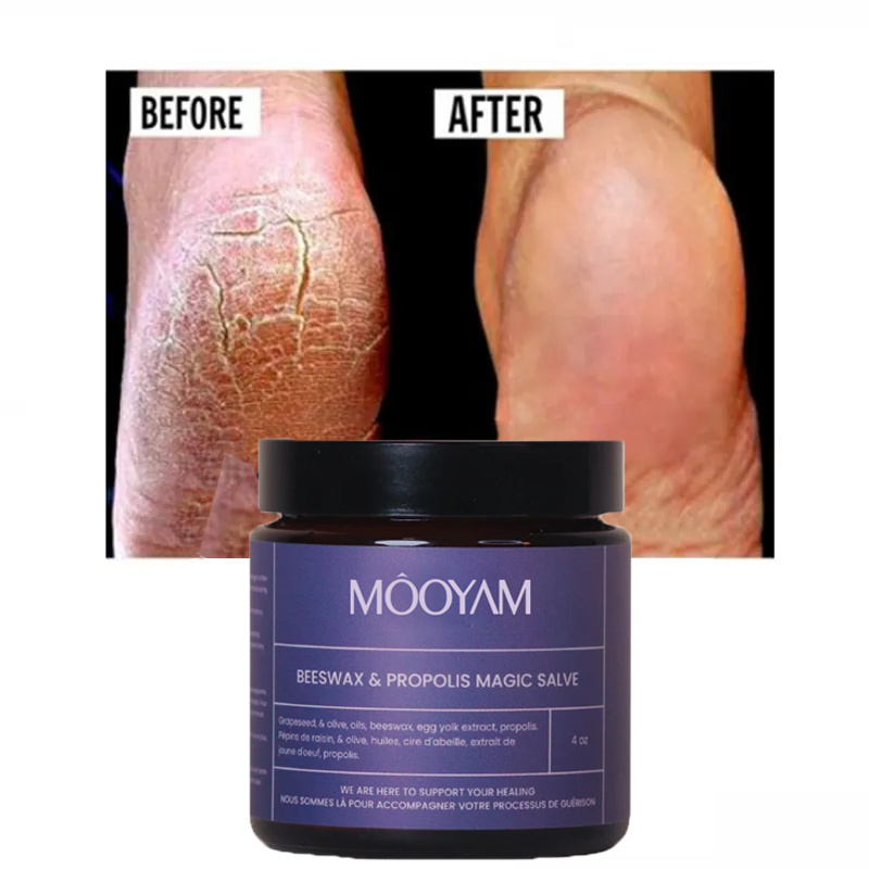 Anti Fungal Foot Repair Foot Scrub Exfoliation Dead Skin Removal Peeling Moisturizing Foot Care Repair Cream for cracked heels