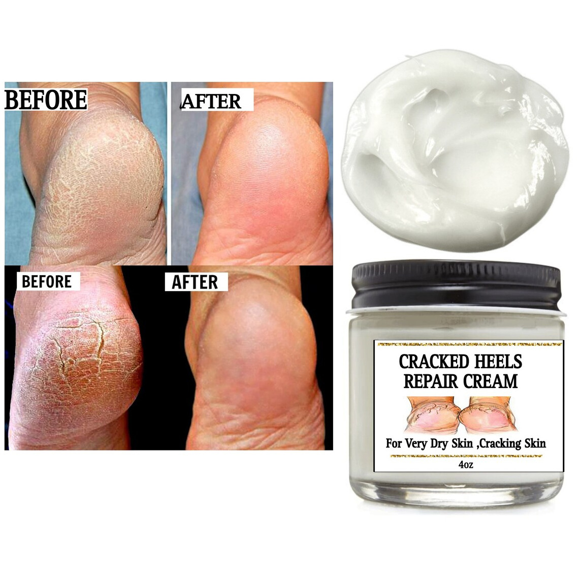 OEM ODM Cracked Heel Repair Tough Callus Remover Gel Callus Remover Cracked heels cream For Feet