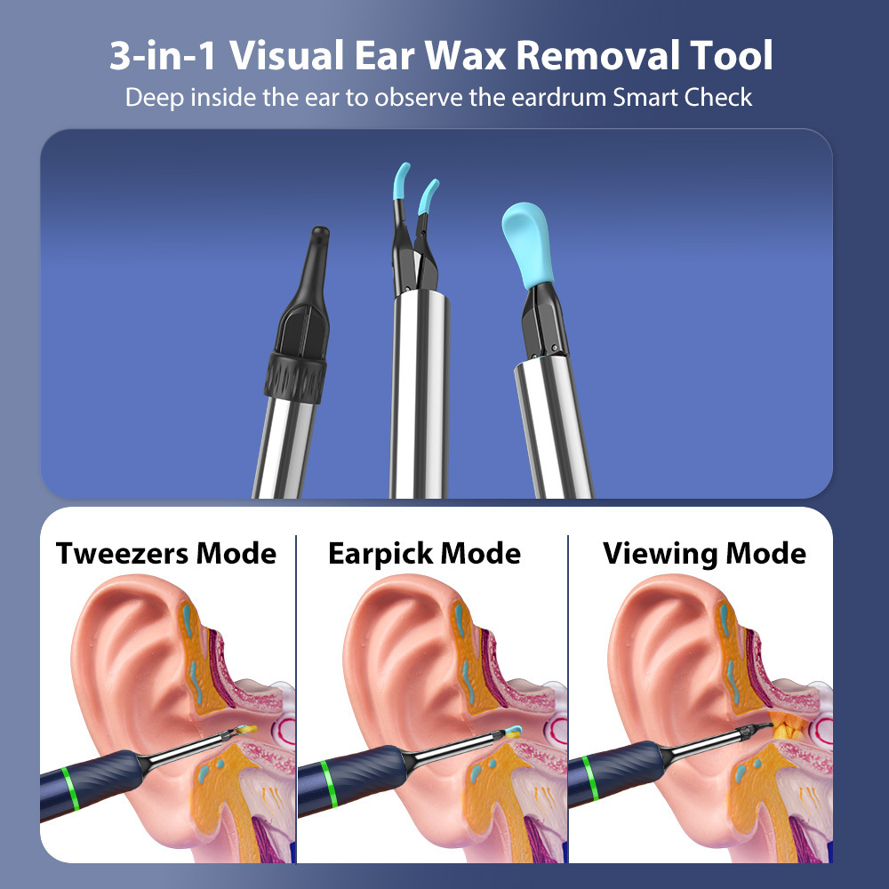 2024 New Trend Beauty Product Health Care Bebird Note 5 Pro Ear Wax Removal Tool  High Precision Digital Ear Cleaner Endotoscope