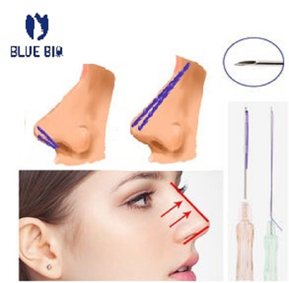 Nose Thread Safe Long Lasting Lifting Thread Barbed 10 Pcs / Bag Pcl Nose Thread