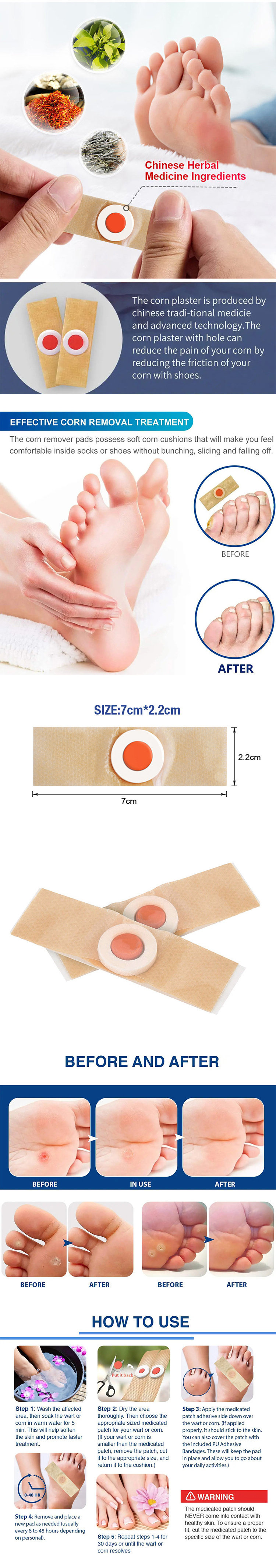 BLUENJOY Best Trending Products New Arrivals Foot Corn Removal Plaster Home Care Factory Corn Removal Patch