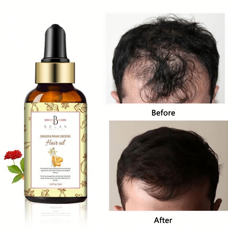 Stem Cell Supplement Quality Oil Natural Herbs Loss Treatment For Women Serum Hair Growth Intense