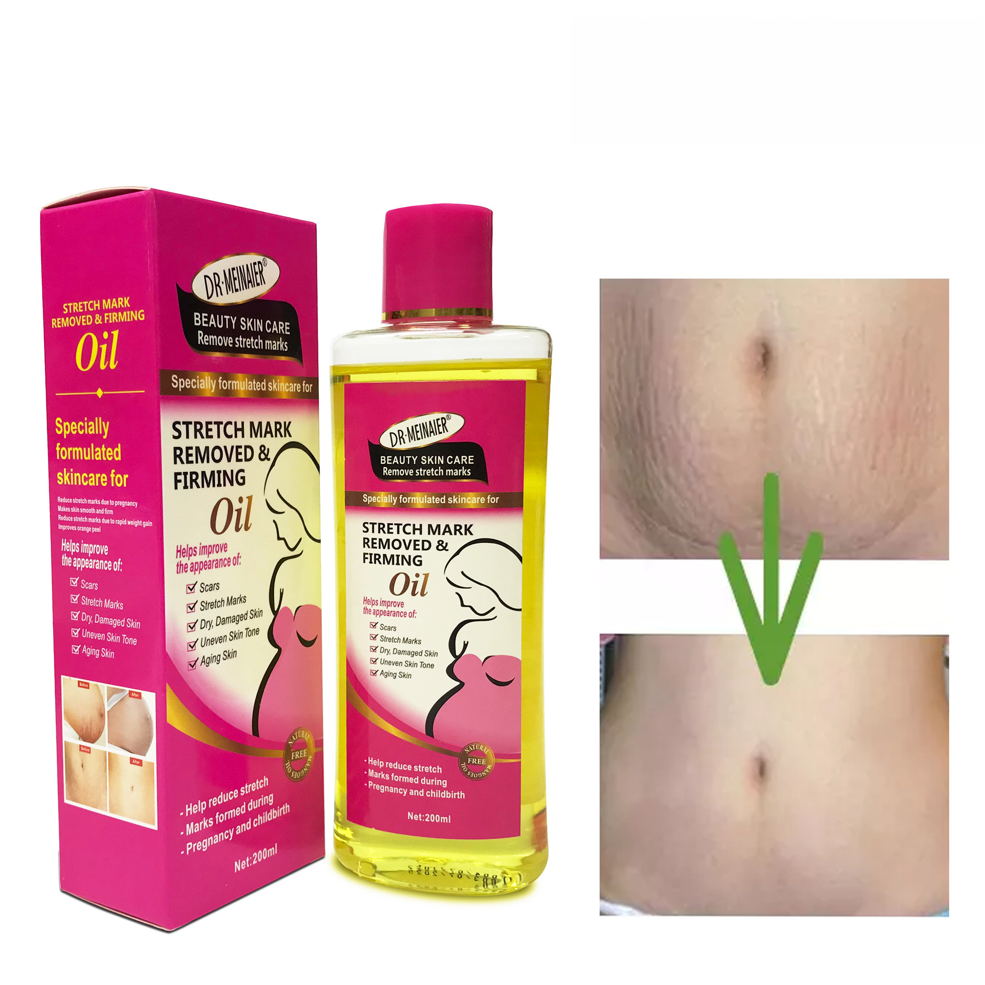 DR.MEINAIER  STRETCH MARK REMOVED & FIRMING OIL