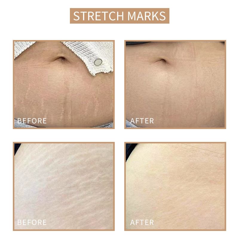 Stretch Mark face paint scar camouflage tattoo ink permanent make up pmu pigments skin treatment 0