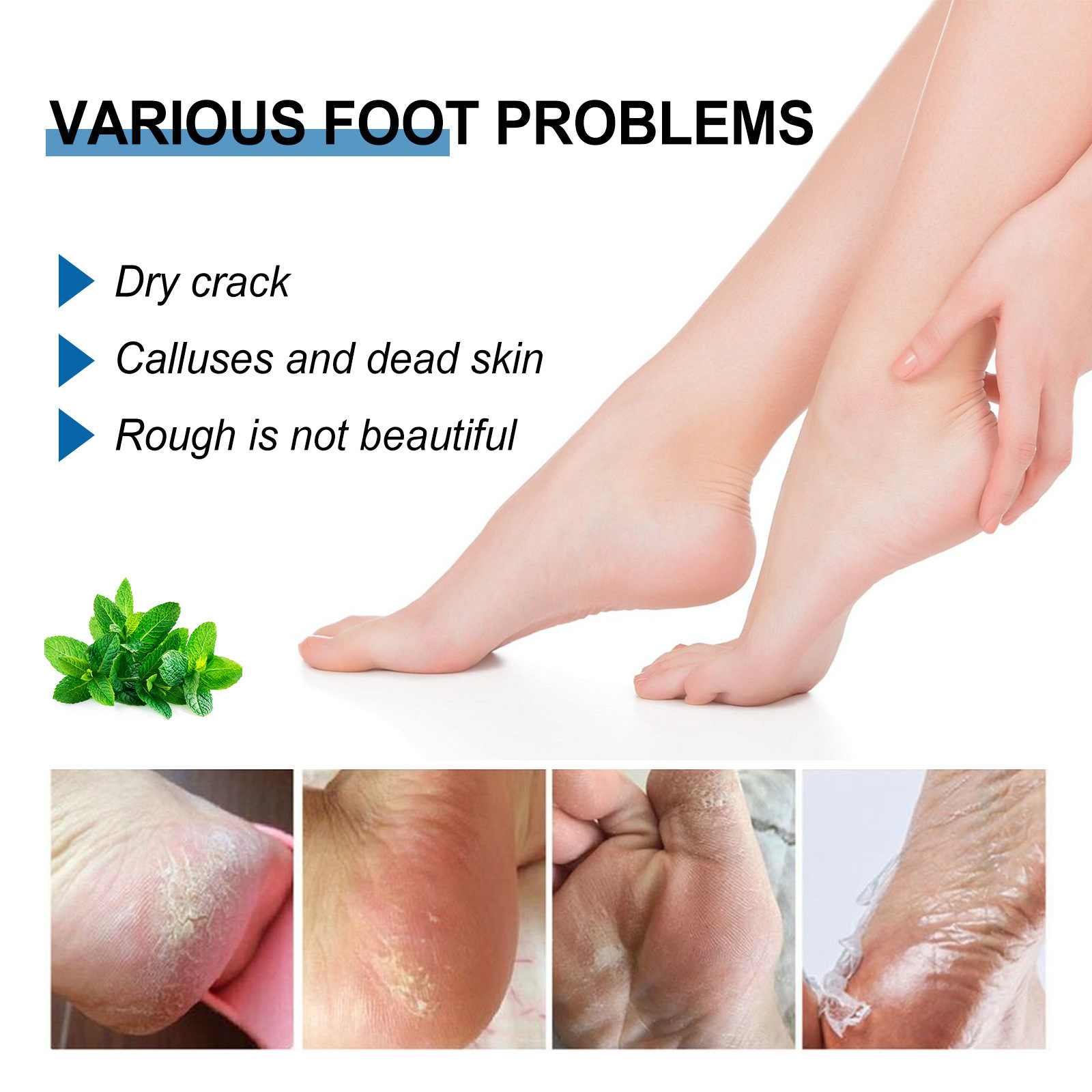 Eelhoe Foot Cracked Peel Heels Repair Balm Pain Relief Footintensive Whitening Foot Peel Advanced Repair Cream Stick Adults