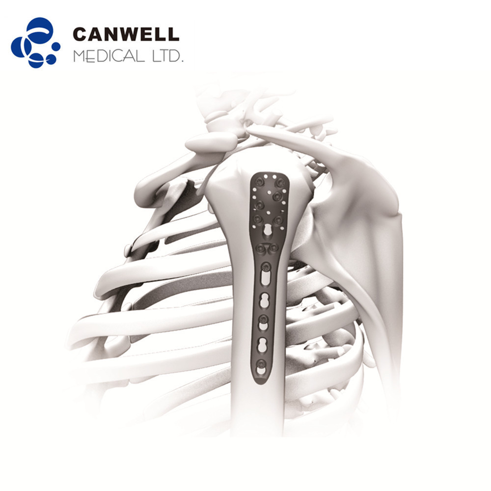 CANWELL Orthopedic Implants Titanium Humeral Locking Plate  Proximal Humerus Locking Plate