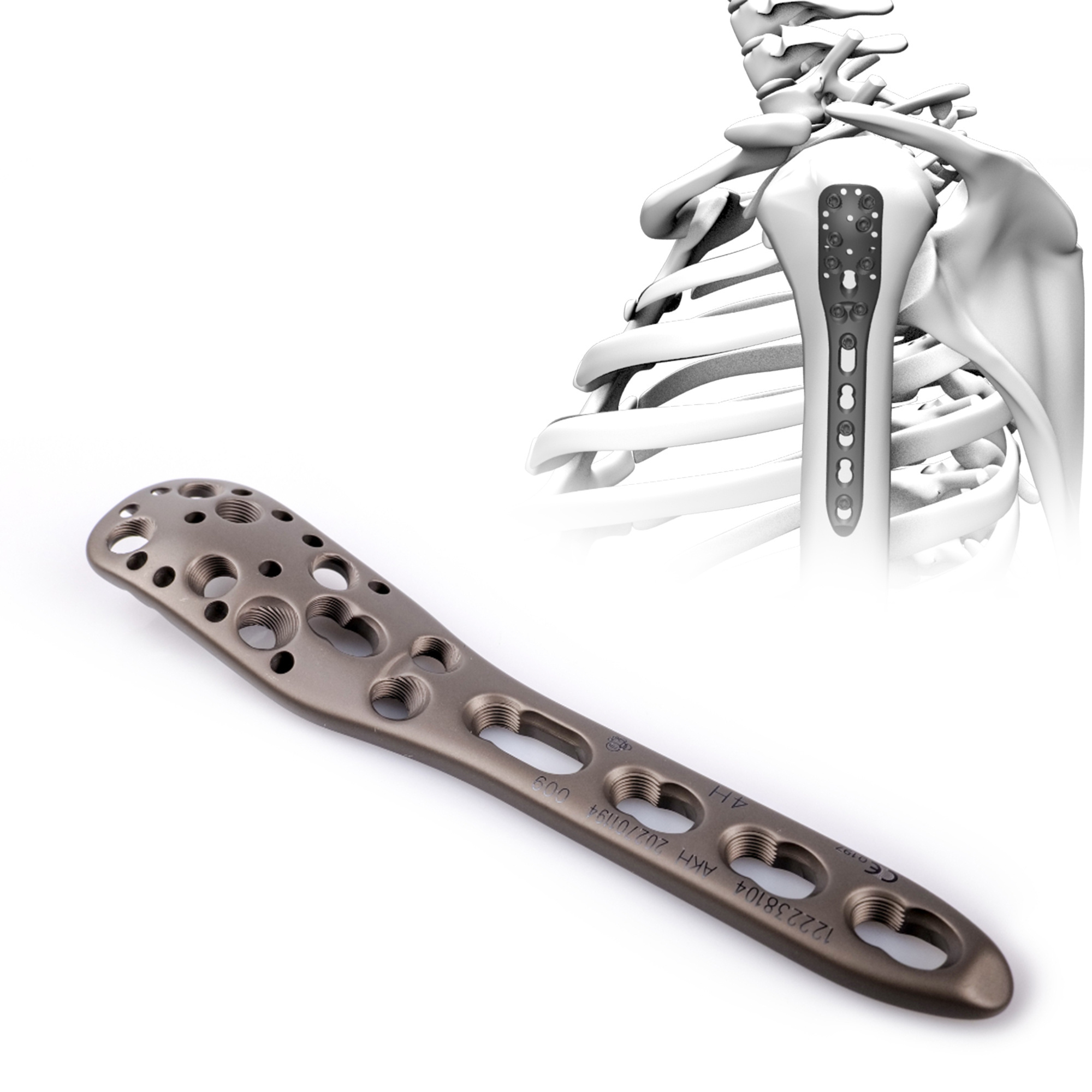 CANWELL Medical Orthopedic Implants Humeral Fracture Proximal Humerus Locking Plate Price