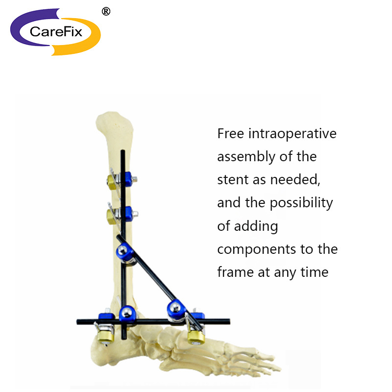 CareFix large trauma orthopedic carbon fiber combined external knee fixation