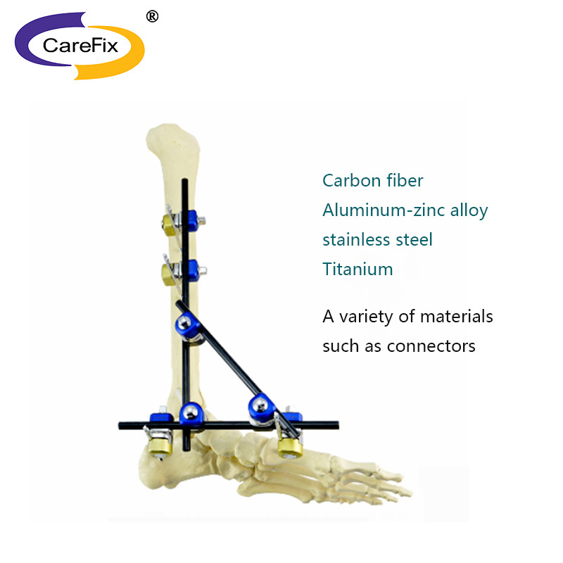 CareFix large trauma orthopedic carbon fiber combined external knee fixation