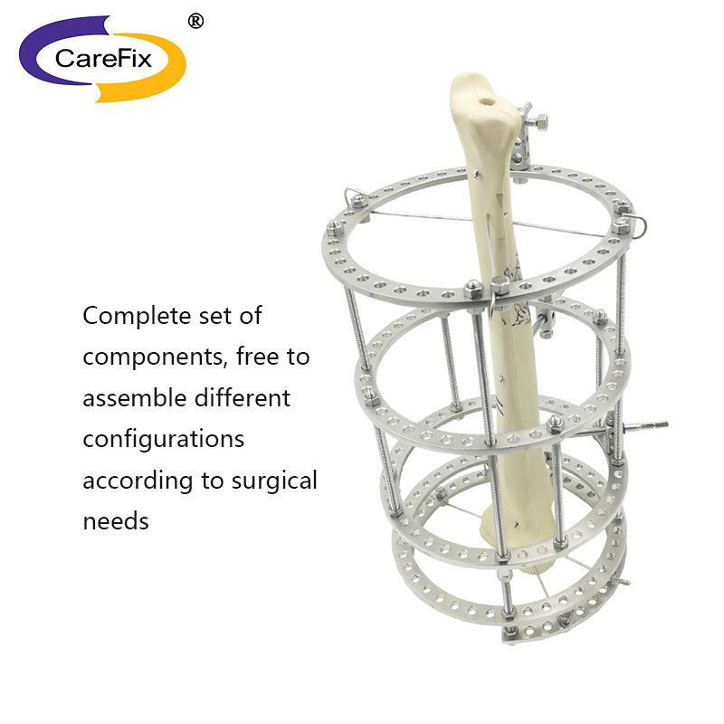 Orthopedic Fixation Surgery Fixation Equipment Large Fragment External Fixation