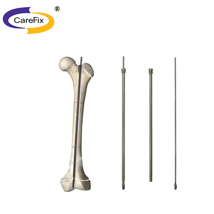 Trauma Implants Stainless Steel Orthopedic Intramedullary Nail